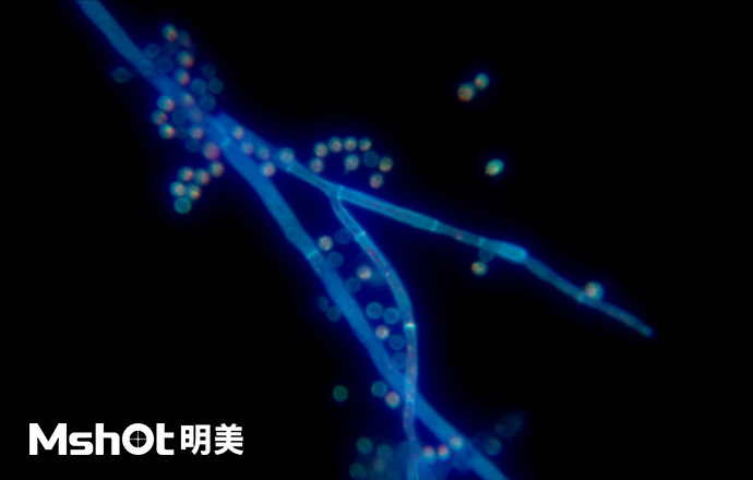 熒光生物顯微鏡下的黃曲霉？