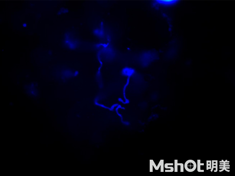 熒光生物顯微鏡應用于醫院皮膚真菌檢查