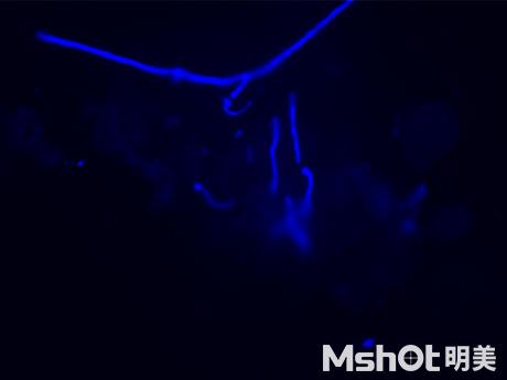 熒光生物顯微鏡應用于醫院皮膚真菌檢查