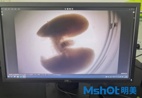 體視熒光顯微鏡用于觀(guān)察小鼠肺