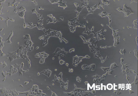熒光生物顯微鏡應用于A(yíng)NA-HEp2免疫熒光診斷