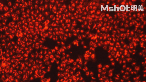 熒光生物顯微鏡應用于A(yíng)NA-HEp2免疫熒光診斷