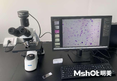 熒光生物顯微鏡應用于A(yíng)NA-HEp2免疫熒光診斷