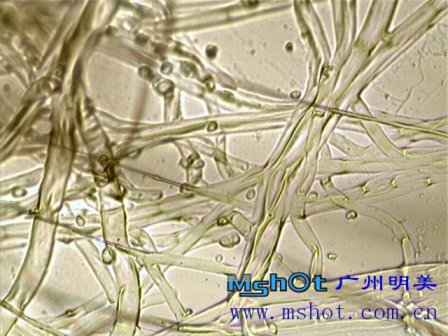 數碼生物顯微鏡應用之試劑檢驗顯微鏡檢法